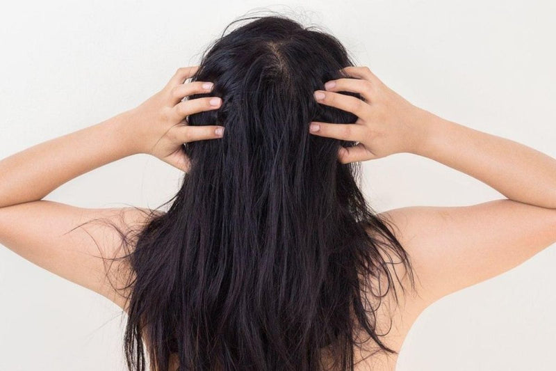 Seborrheic Dermatitis and how to successfully defeat it