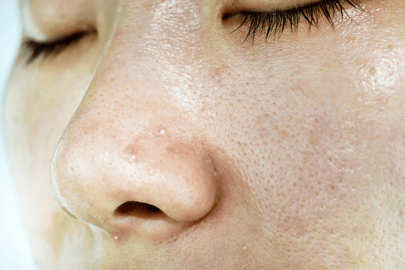 What skin type am I?