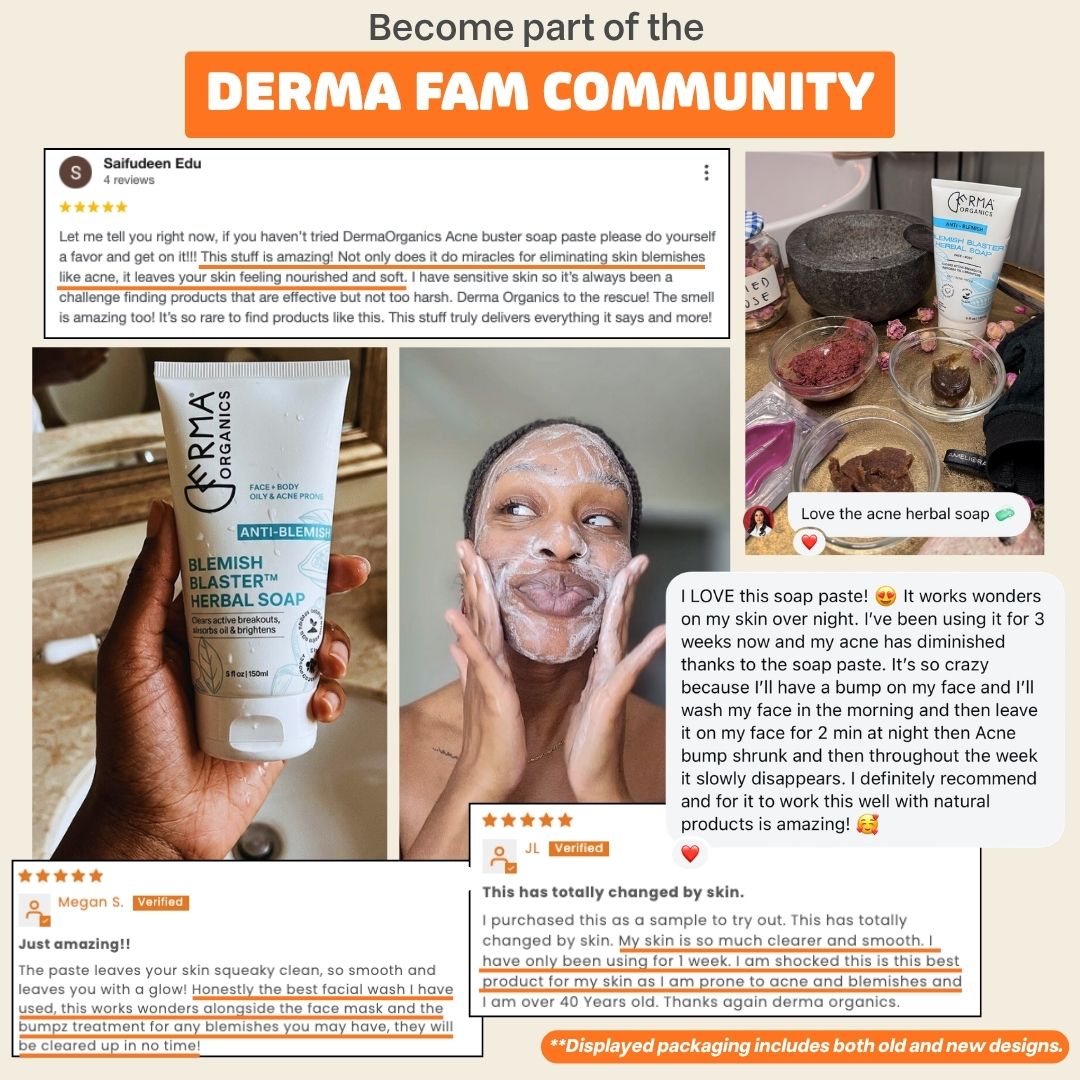 Blemish Blaster Herbal Soap Paste™