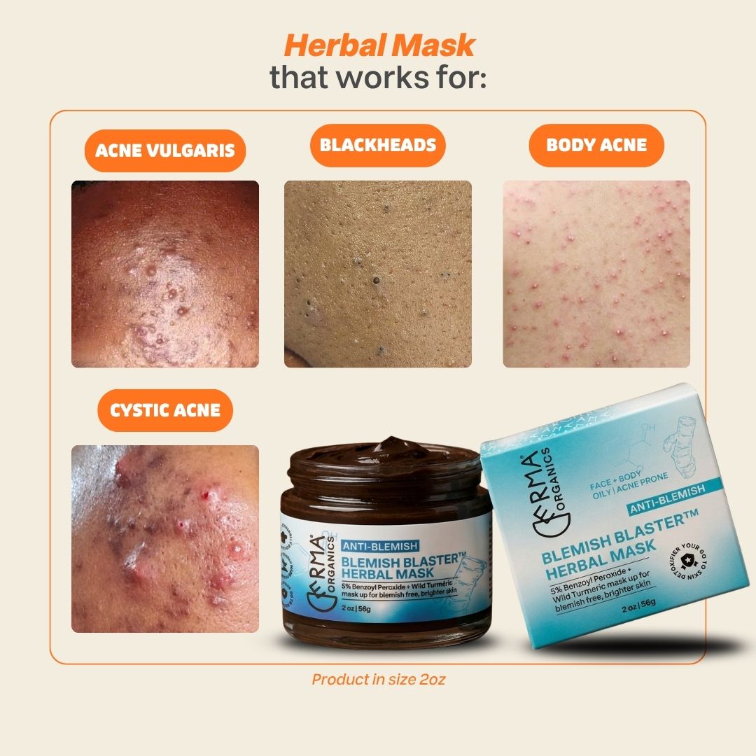 Blemish Blaster Herbal Mask™