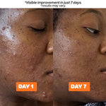 Blemish Blaster Herbal Mask™