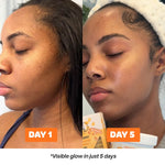 Brightening Equalizer Facial Moisturizer™
