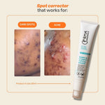 Bumpz n’ Stumpz Topical Eraser™