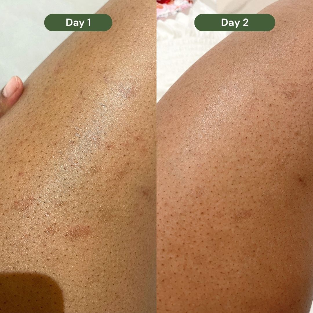 Inside-Out Skin Healing Bundle