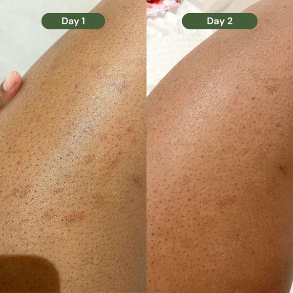 Inside-Out Skin Healing Bundle alternate view