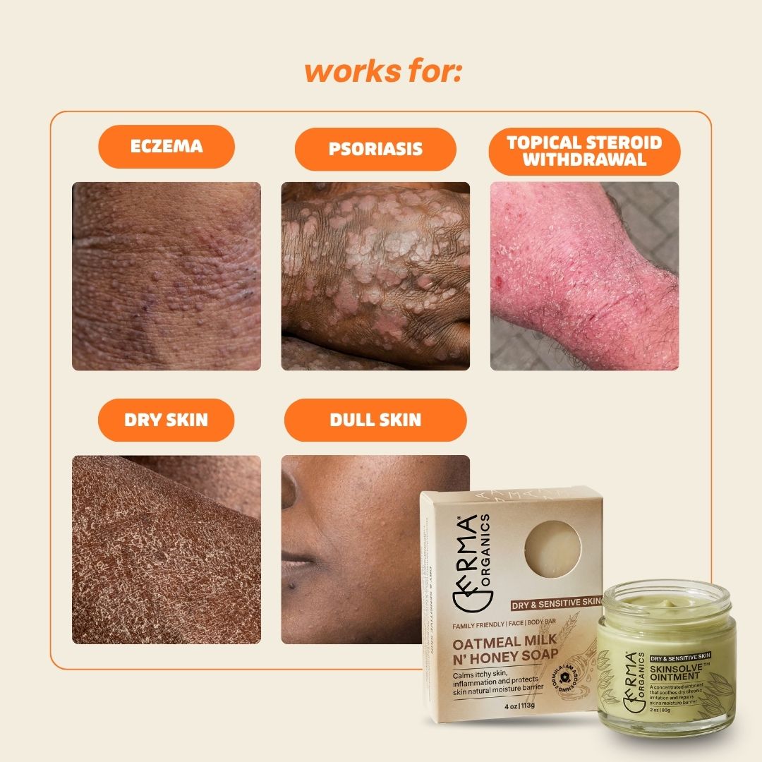 Eczema + Psoriasis + TSW Relief Duo