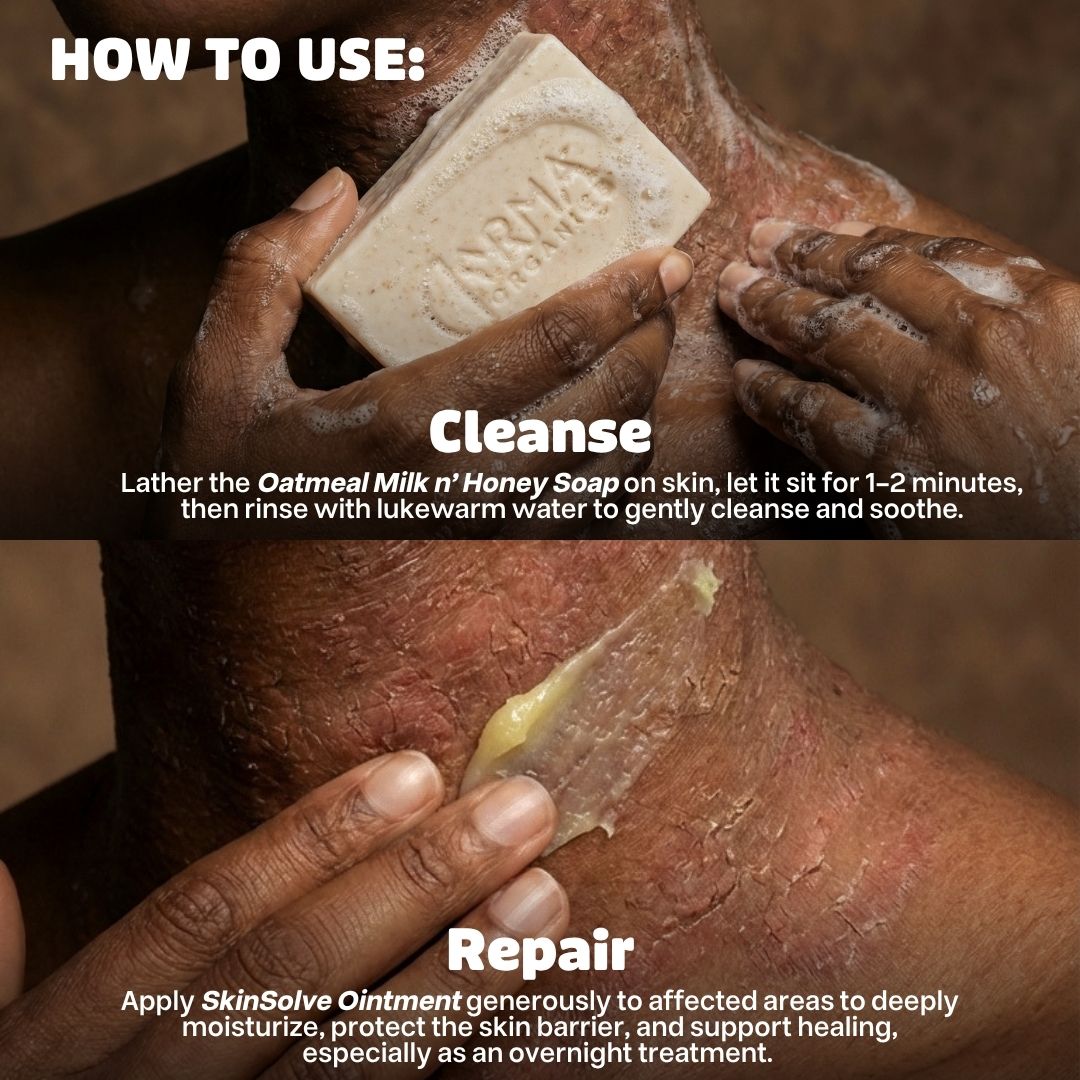 Eczema + Psoriasis + TSW Relief Duo