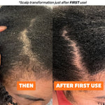 Scalp Stimulating Grease