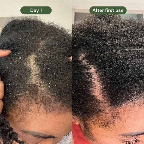 Scalp Relief + Internal Healing Bundle alternate view