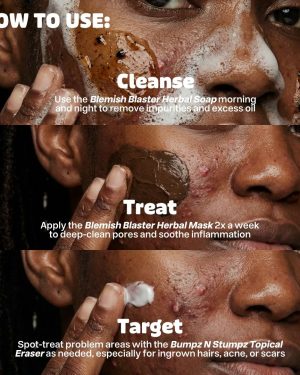 acne-6