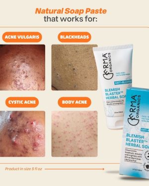 blemish-blaster-3