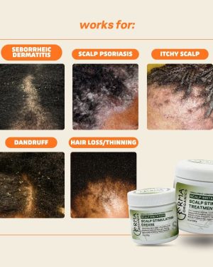 seb-derm-2