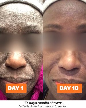 skinsolve