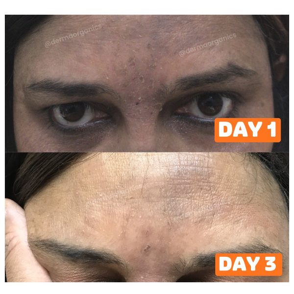 skinsolve-1