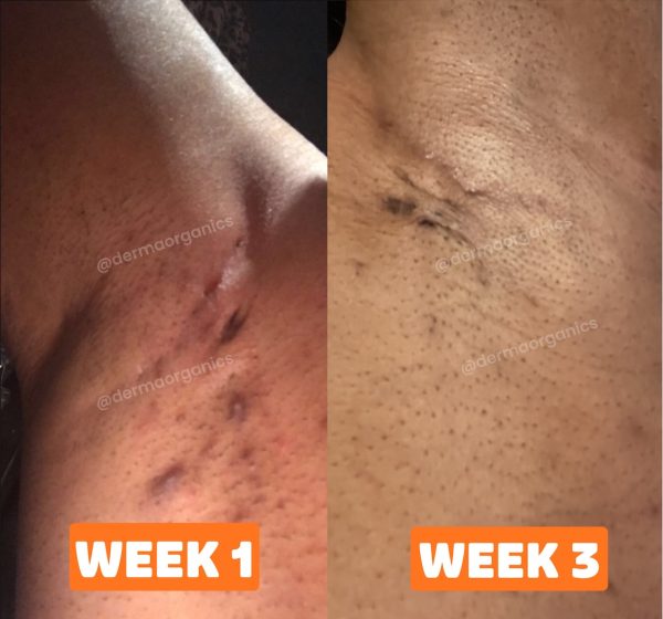 skinsolve-3