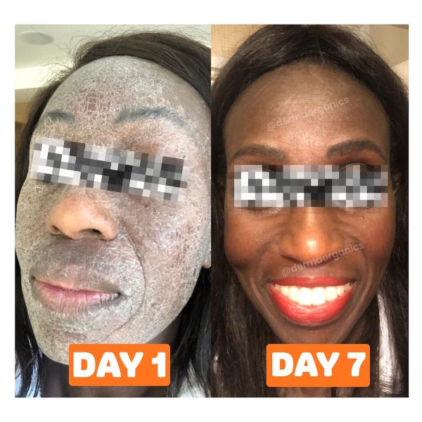 skinsolve-4
