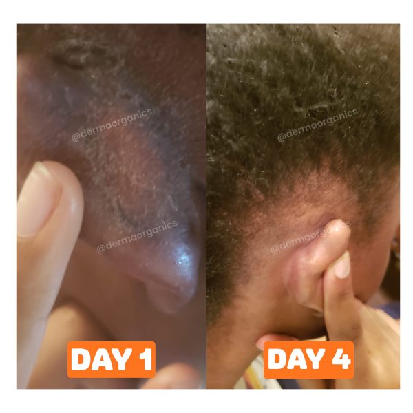 skinsolve-5